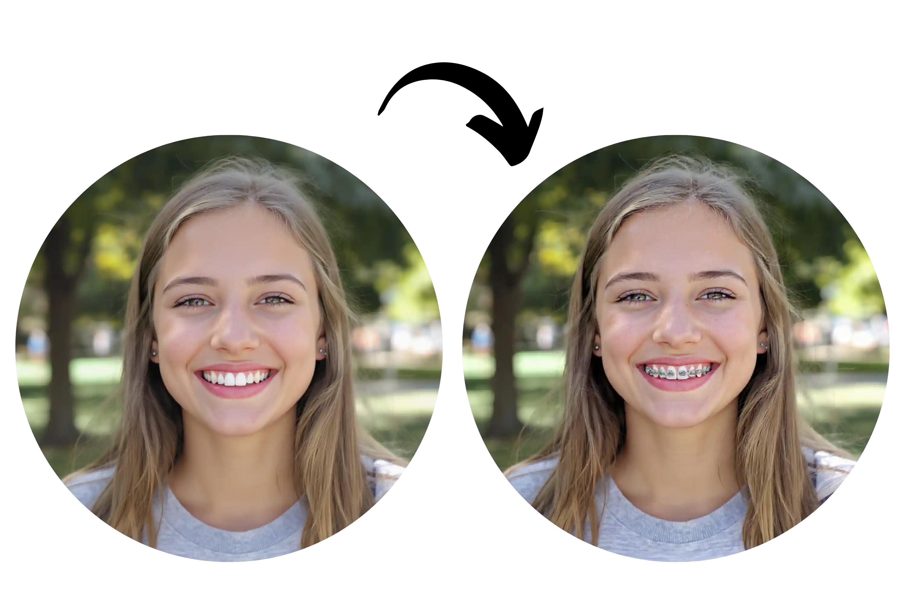 Realistic AI Braces Filter Technology