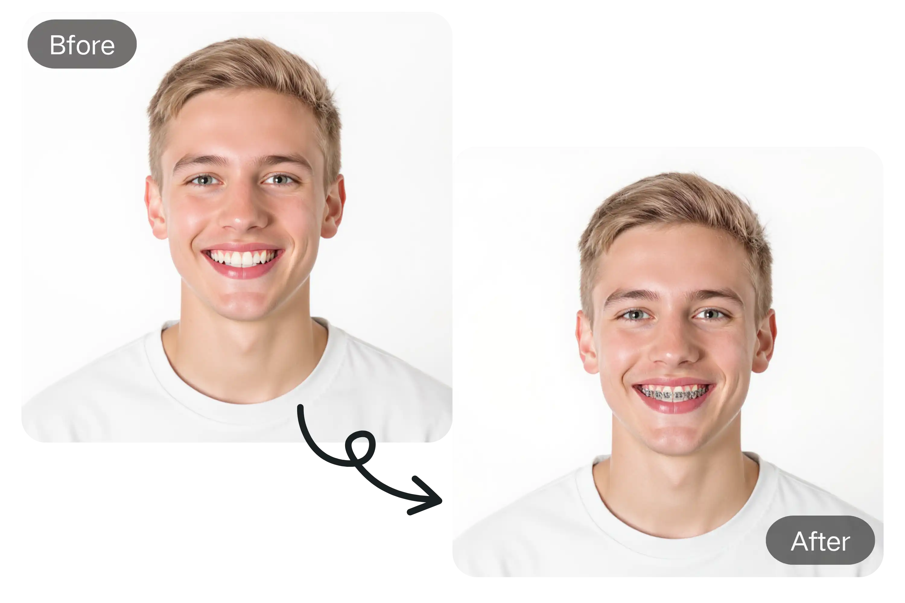 Virtual Braces Try-On Before Orthodontic Treatment