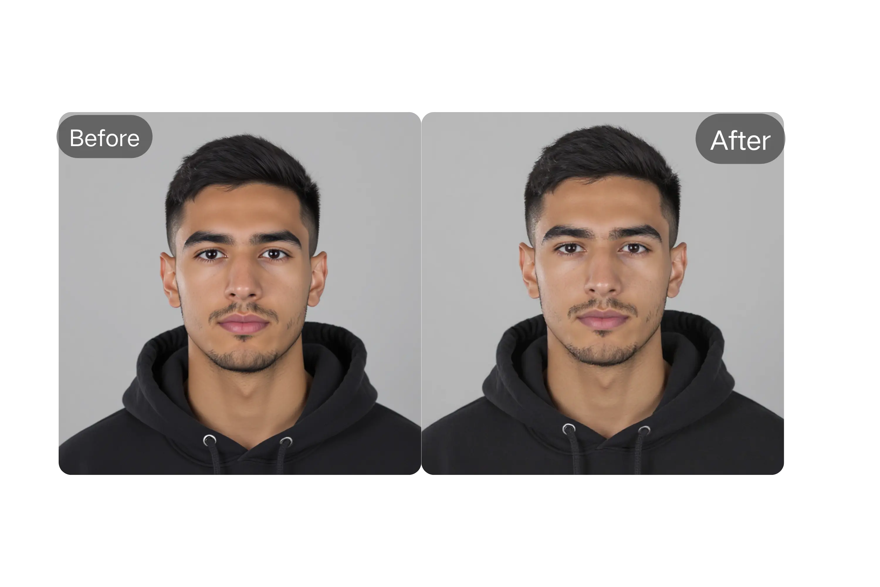 Advanced Face Slimming and Shaping